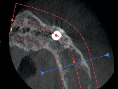 Tutorial on CBCT scans